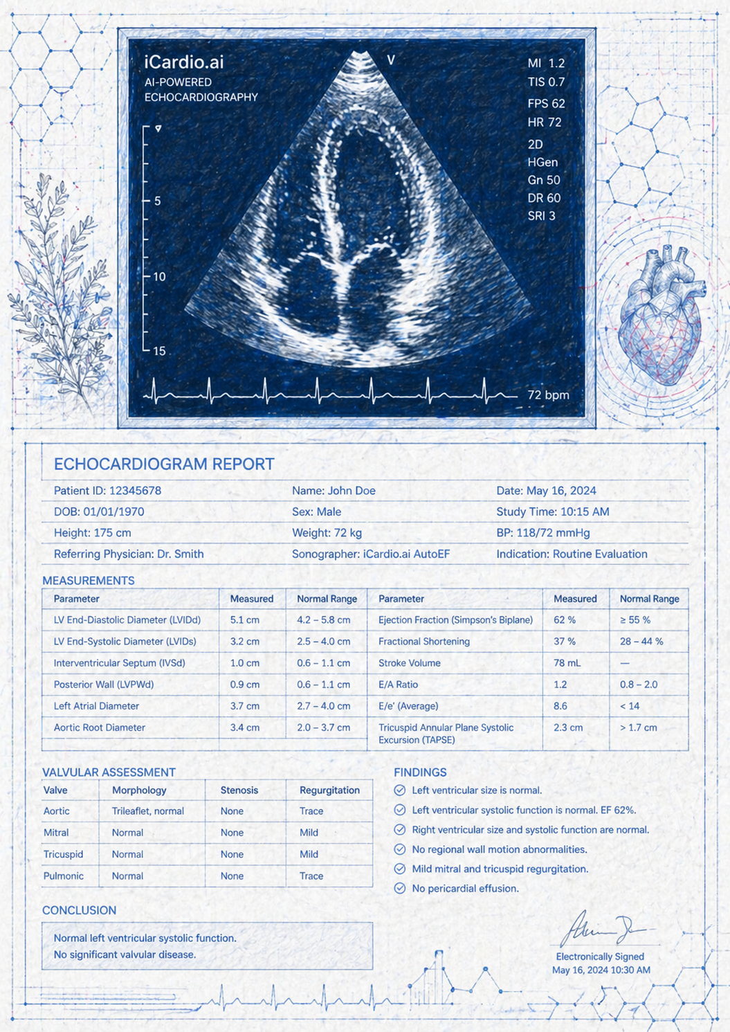Blueprint-style illustration: an AI-powered echocardiography display on the left, with a four-chamber heart cine, MI / TIS / FPS / HR readouts, and an ECG strip — connected by an AI arrow to a structured echocardiographic report on the right showing LV, RV, valve, and impression sections.